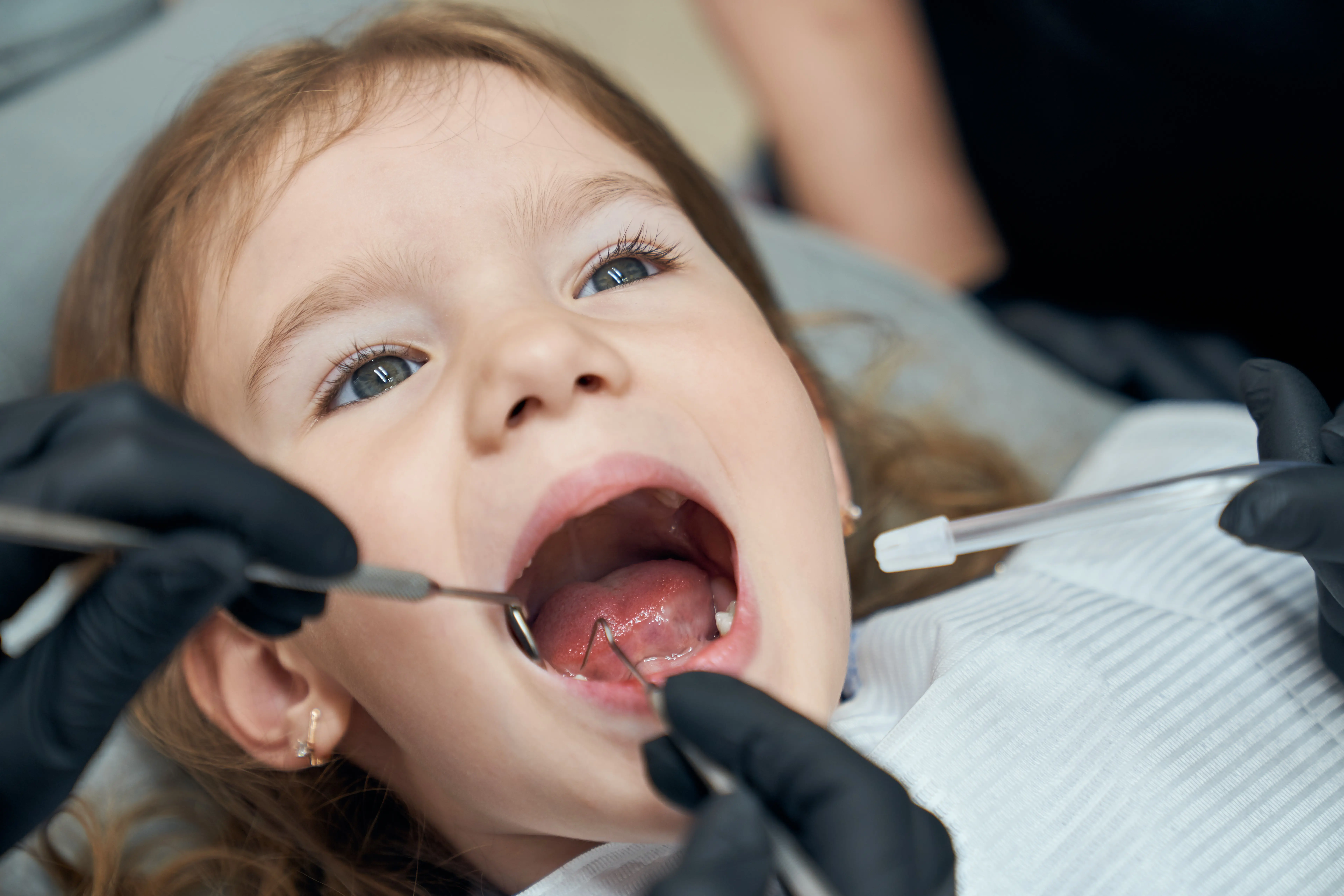 Fillings for Kids